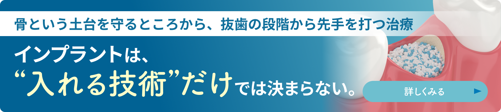 リッジプリザベーション